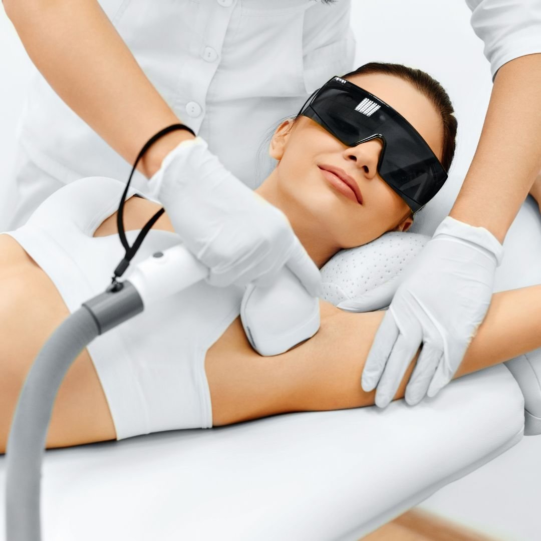 Laser Hair Removal treatment session at DermaGlo Clinic